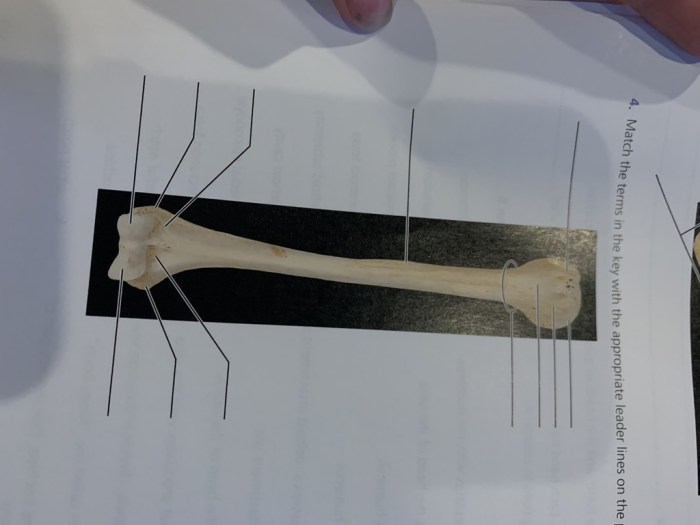 Exercise 9 the appendicular skeleton