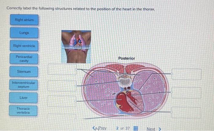 Correctly label the following structures related to the parathyroid gland