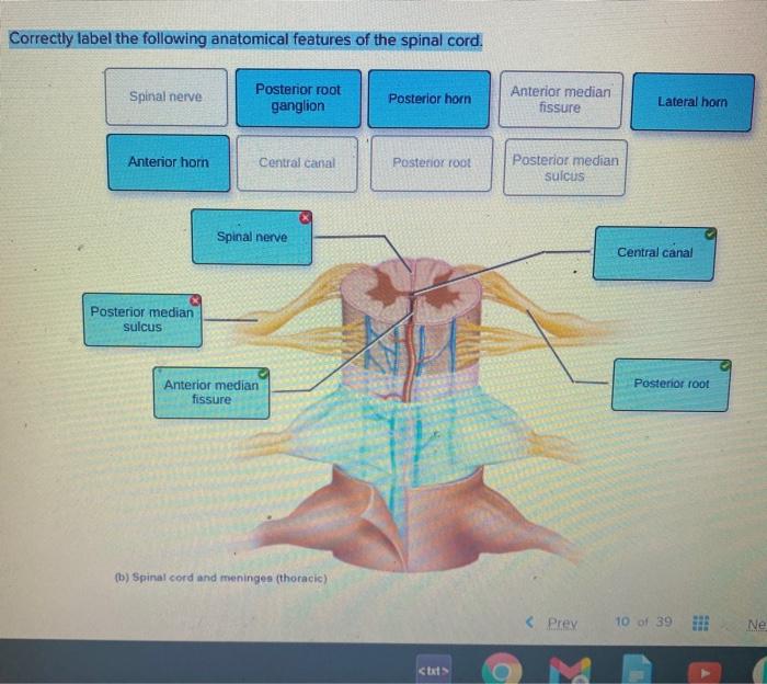 Correctly label the following structures related to the parathyroid gland