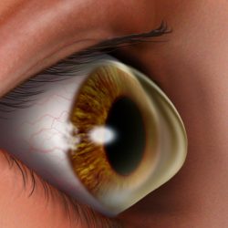 Cornea eyes shape optometry real light