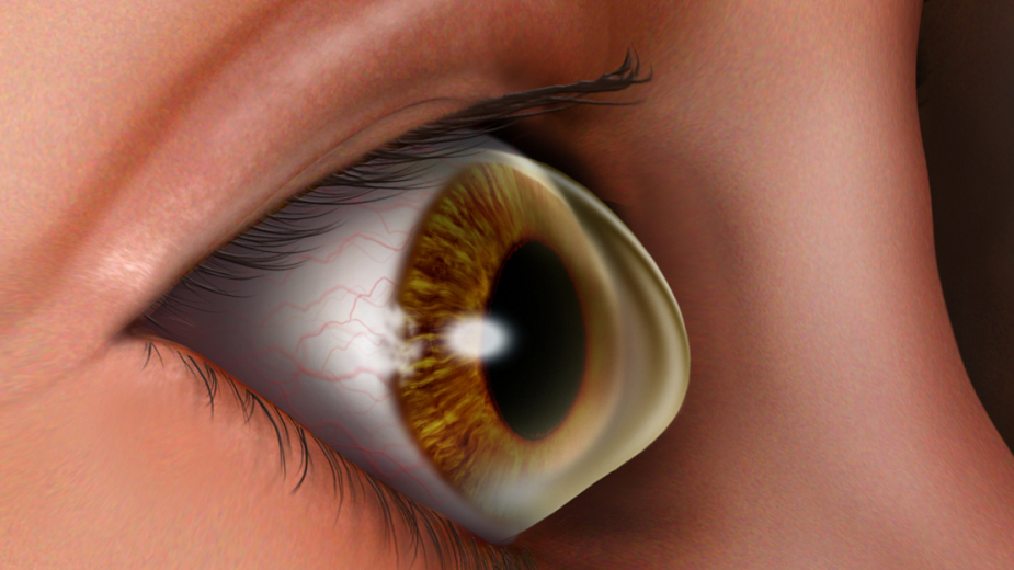 Cornea eyes shape optometry real light